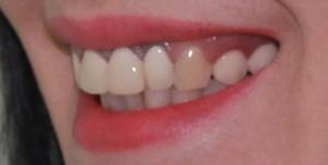 dentist bun si ieftin in bucuresti