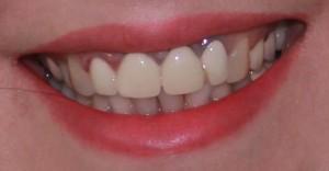 dentist bun si ieftin in bucuresti