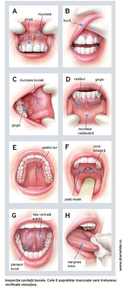 simptome cancer in gura