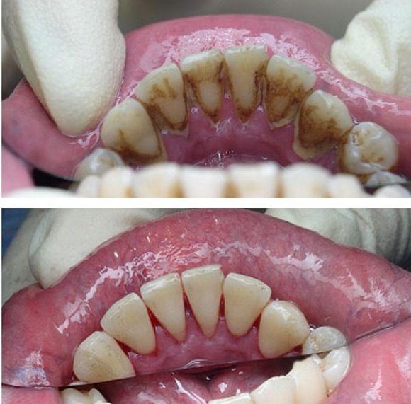 Maxim Performance Frustrating Cabinet stomatologic Bucuresti sector 4 Dentist Dr. Aristide Dan