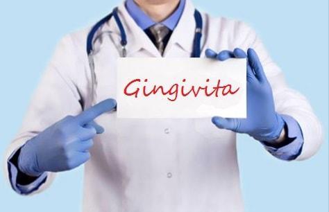 Gingivita - Cauze - Simptome - Tratament