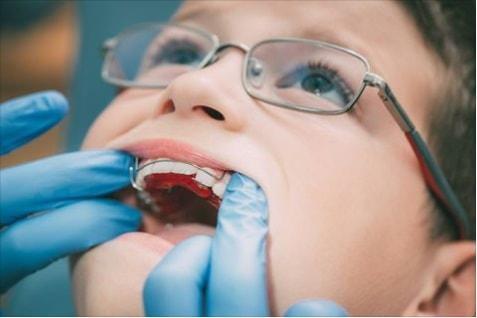 Tratamentul interceptiv al anomaliilor dento-maxilare