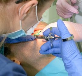 Medic stomatolog utilizând un instrument chirurgical pe un pacient în timpul unei proceduri dentare.