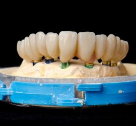 Model de implanturi dentare cu coroane montate pe un suport circular.
