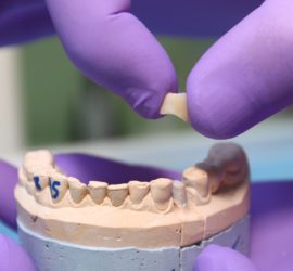 Un tehnician dentar ținând un dinte artificial deasupra unui model dentar.