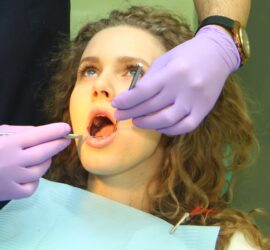 abces dentar