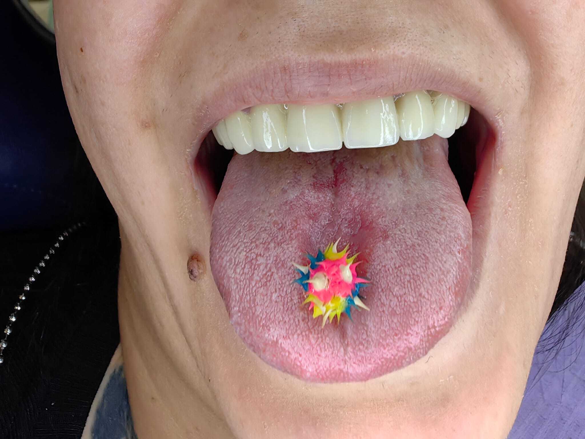 Dr Aristide – imagine cu limbă purtând bijuterie bucală multicoloră în formă de stea, alături de dinți albi vizibili și buze roz deschis.