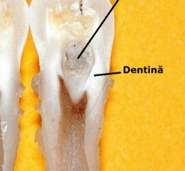 Imagine a unei structuri dentare evidențiind smalțul și dentina pe un fundal galben.