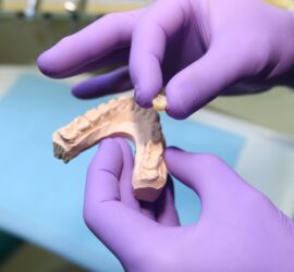 Un model dentar în mâinile unei persoane cu mănuși, ținând o piesă de protetică.