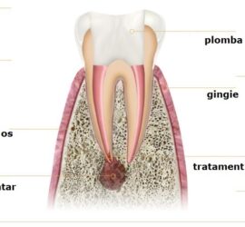 Ilustrație detaliată a anatomiei dintelui uman, inclusiv coroana dentară și rădăcina dintelui.