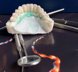 Model dentar cu coroane din ceramică și instrumente dentare pe o suprafață de lucru.