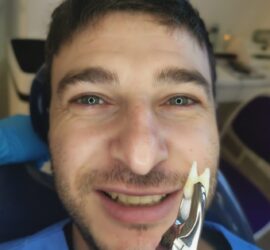 Medic stomatolog ținând un instrument dentar lângă un dinte extras din gura unui pacient.