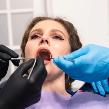 Femeie pe scaun la dentist cu multe instrumente medicale in gura